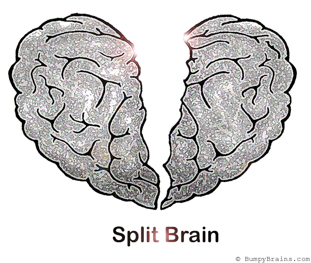 Split Brain